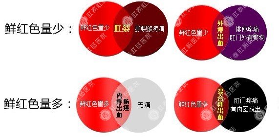 便血